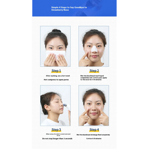 MK 1527 – Derma Suction Blackheads Remover (1)